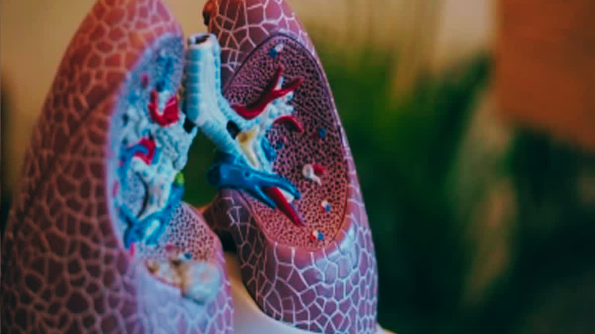 Do you also experience difficulty breathing? Could you be suffering from Emphysema?