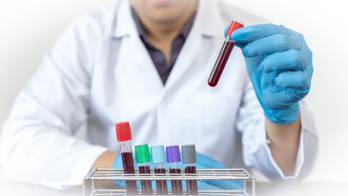 New blood group discovered