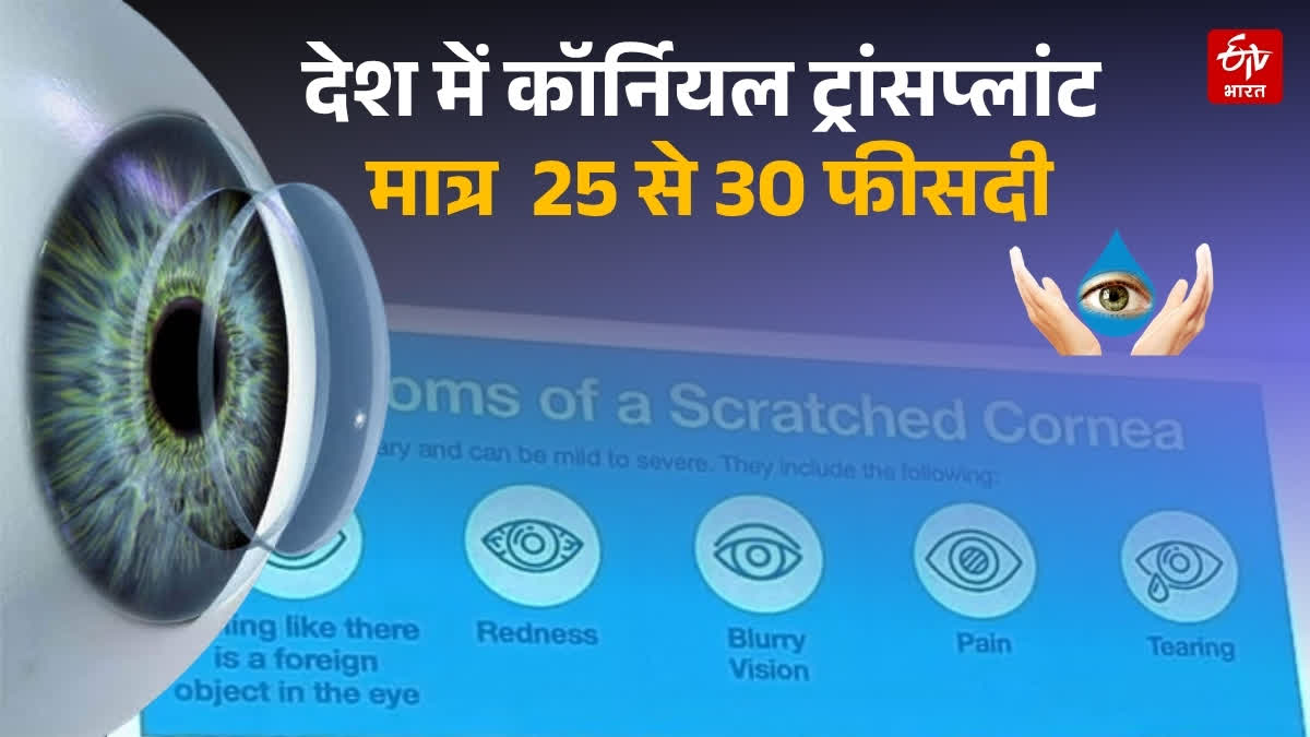 कॉर्नियल ट्रांसप्लांट