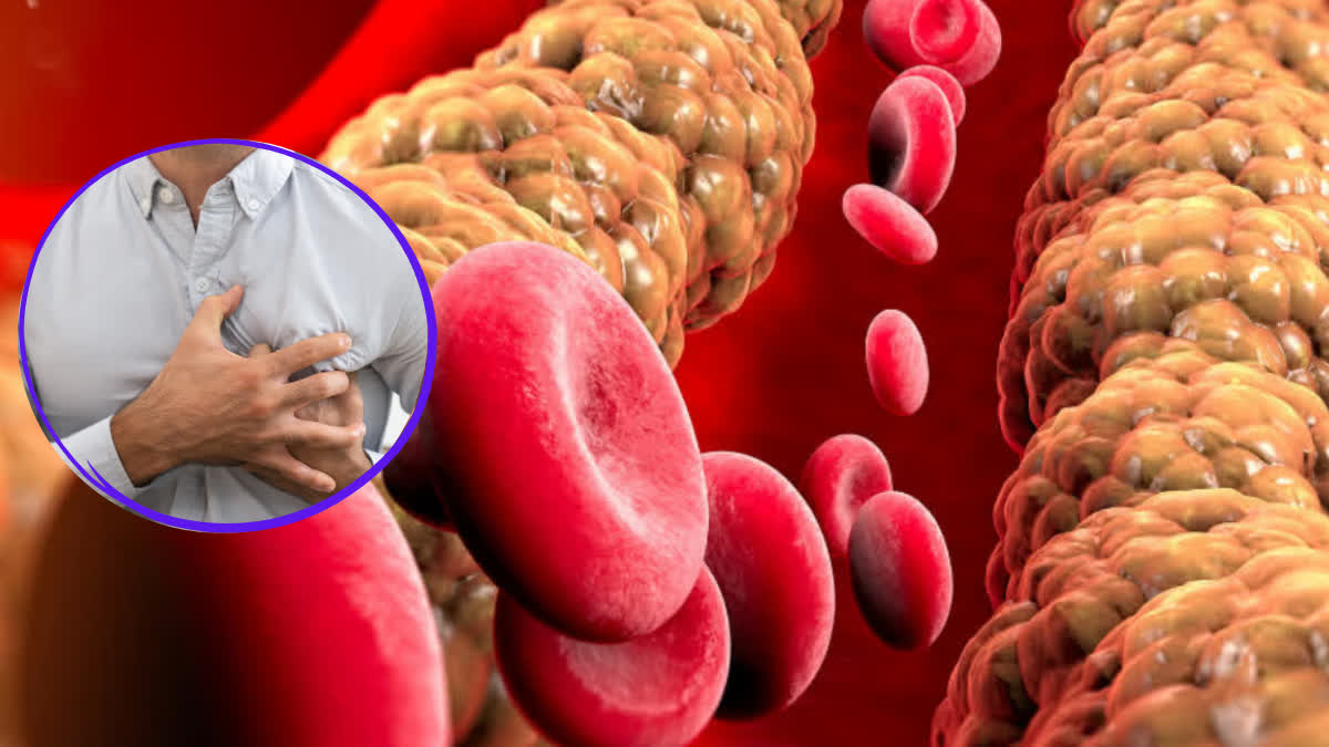 શરીરમાં આ લક્ષણો દેખાય તો તરત જ થઇ જાઓ સાવધાન! તમારૂ ઝડપથી વધી રહ્યું છે કોલેસ્ટ્રોલનું લેવલ