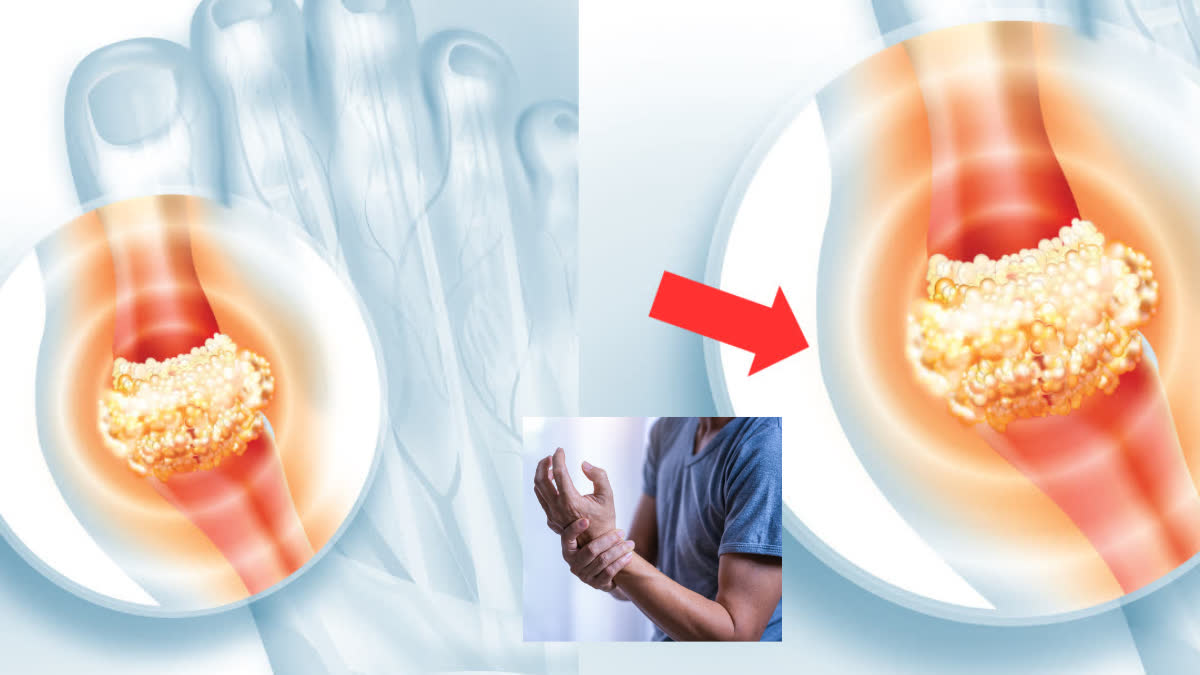 શું તમે જાણો છો શરીરમાં યુરિક એસિડનું લેવલ વધી જાય તો શું થાય છે?