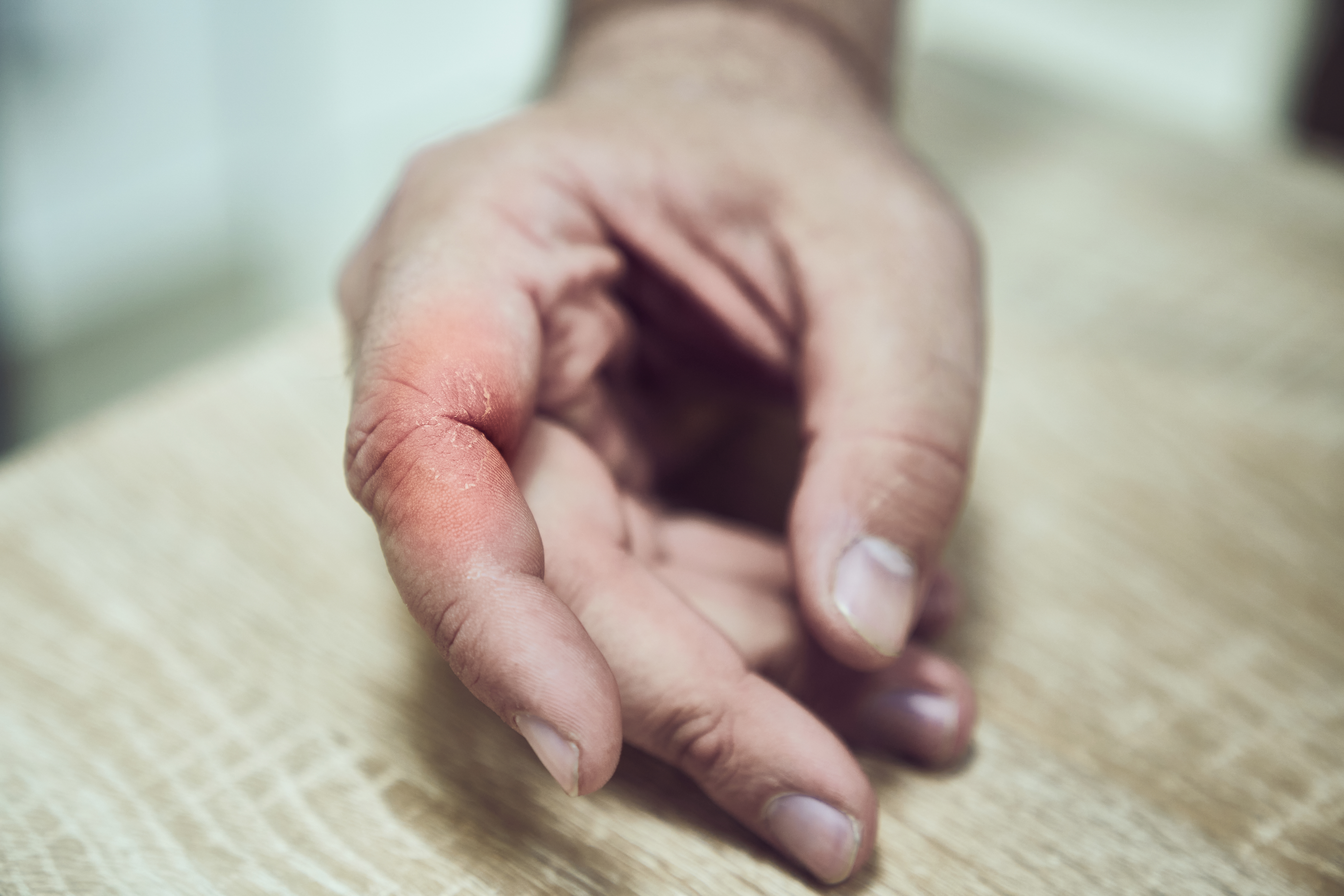 શું તમે જાણો છો શરીરમાં યુરિક એસિડનું લેવલ વધી જાય તો શું થાય છે?