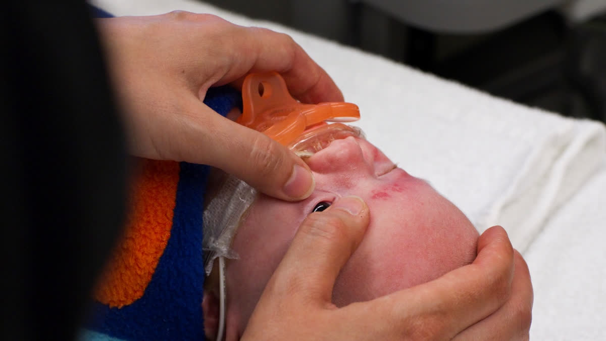 What Every Parent Of A Premature Baby Should Know For Preventing Blindness | Retinopathy of Prematurity Awareness Week 2026 Premature baby