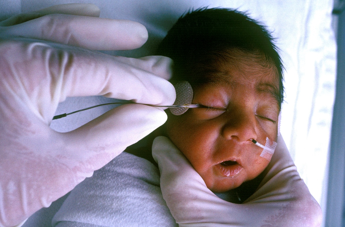 Doctor testing a preemie's eyes