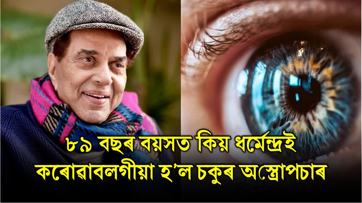 What is Eye Grafting? A Guide to the Surgery Actor Dharmendra Recently Underwent at age of 89