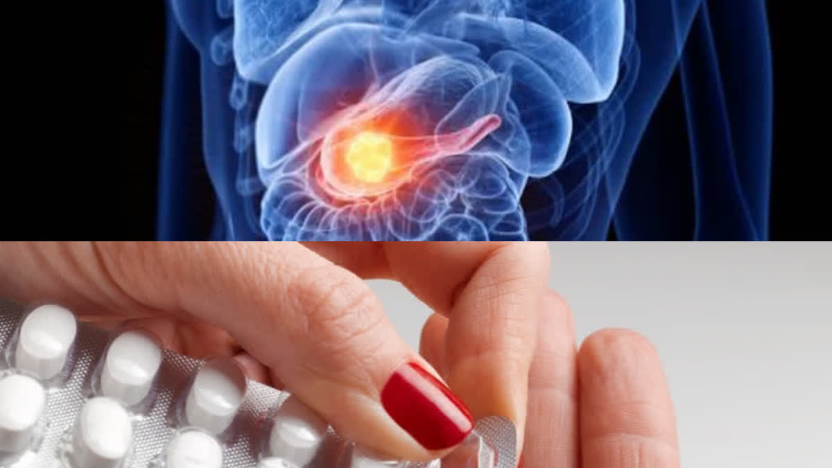 In a trial for pancreatic cancer, the new drug Daraxonrasib doubled the survival rate of cancer patients.