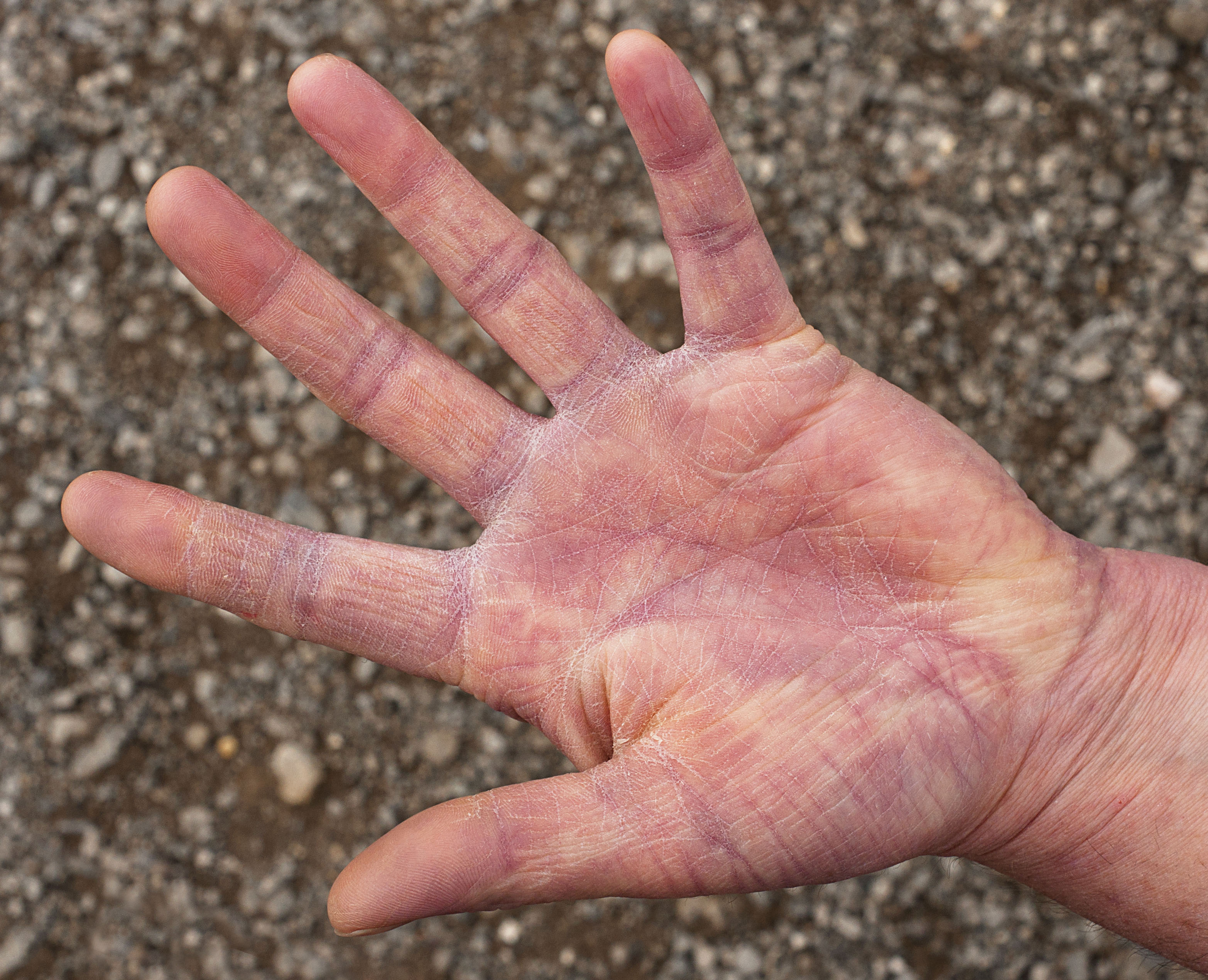 You can determine whether or not your liver is healthy by examining these two parts of the body