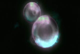 Scientists Create 'SpudCell', An Artificial Cell That Grows Replicates And Divides