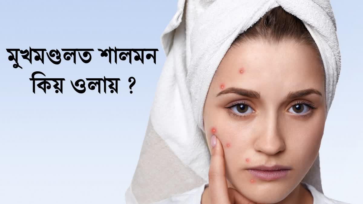 Learn about the causes of pimples on the skin and understand some important factors involved