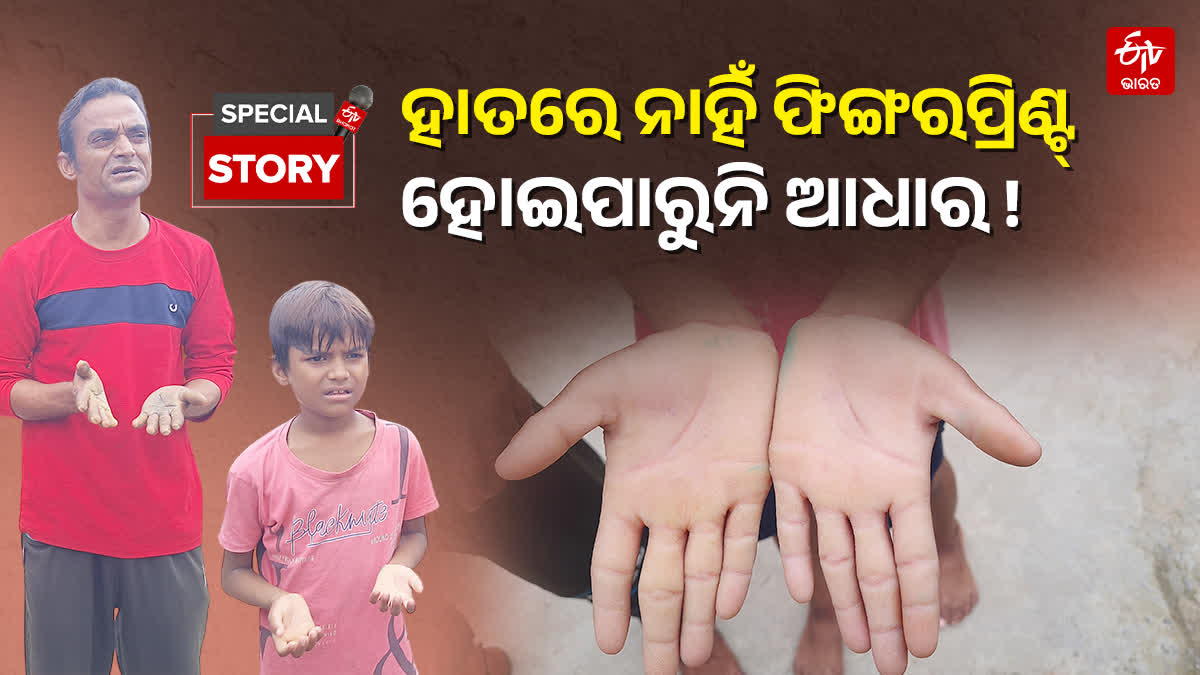 No Fingerprints No Aadhaar