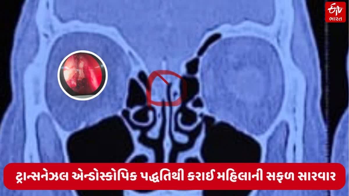નાકની જટિલ સર્જરી