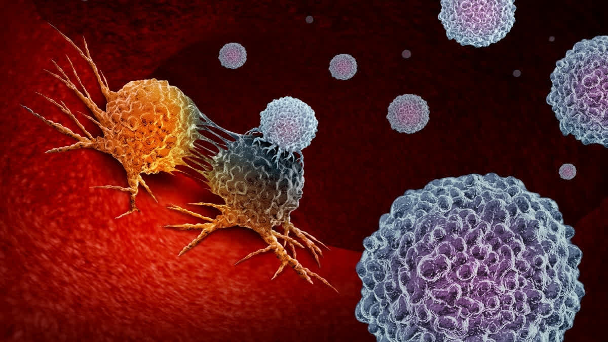 Prostate Cancer Can Be Kept In Check With Early Detection And Timely Treatment: Urologist