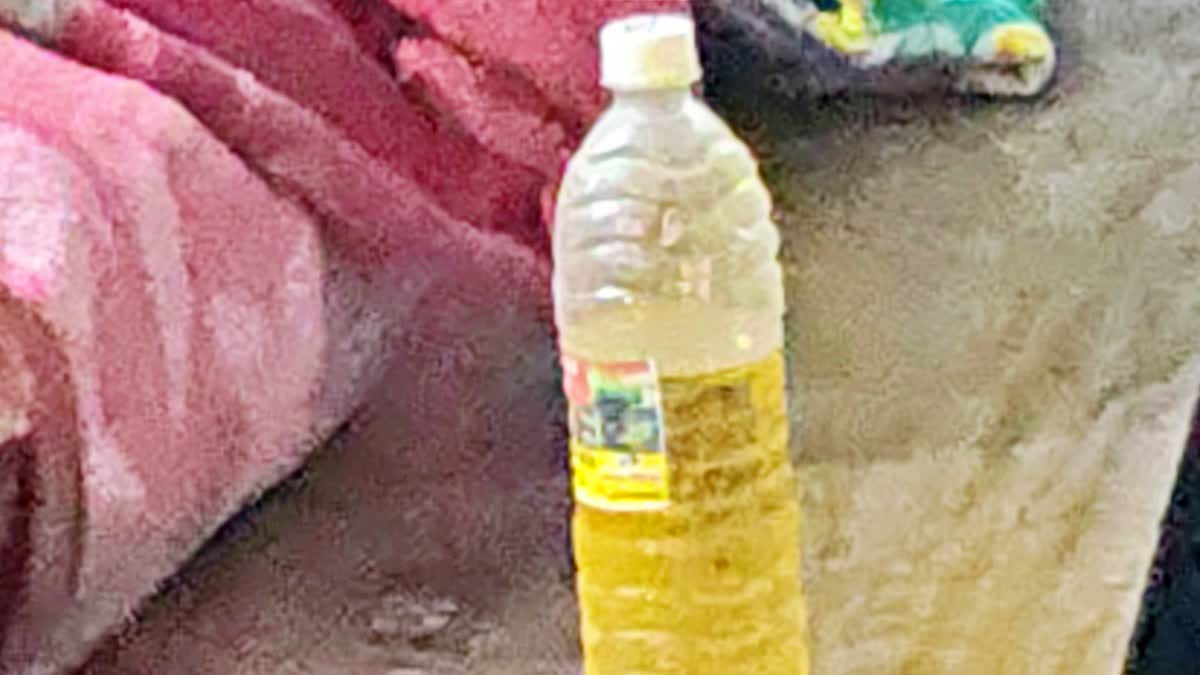 Acid attack in Bhagalpur