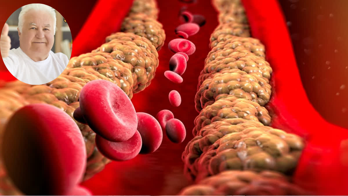 Can high cholesterol levels in the body occur without any symptoms? How can this be detected?