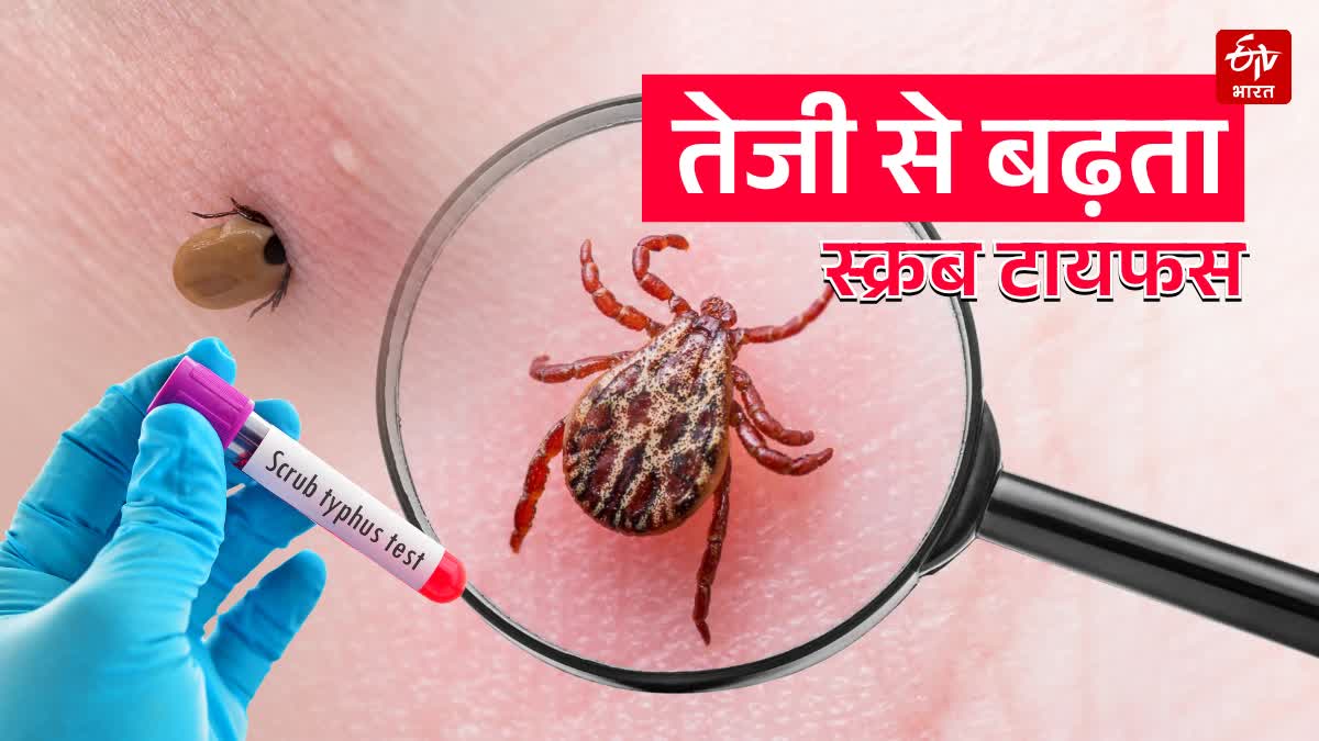 SCRUB TYPHUS INCREASING RAPIDLY