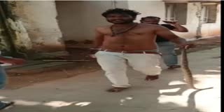 Man Came Hospital With Snake