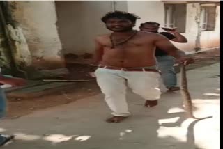 Man Came Hospital With Snake