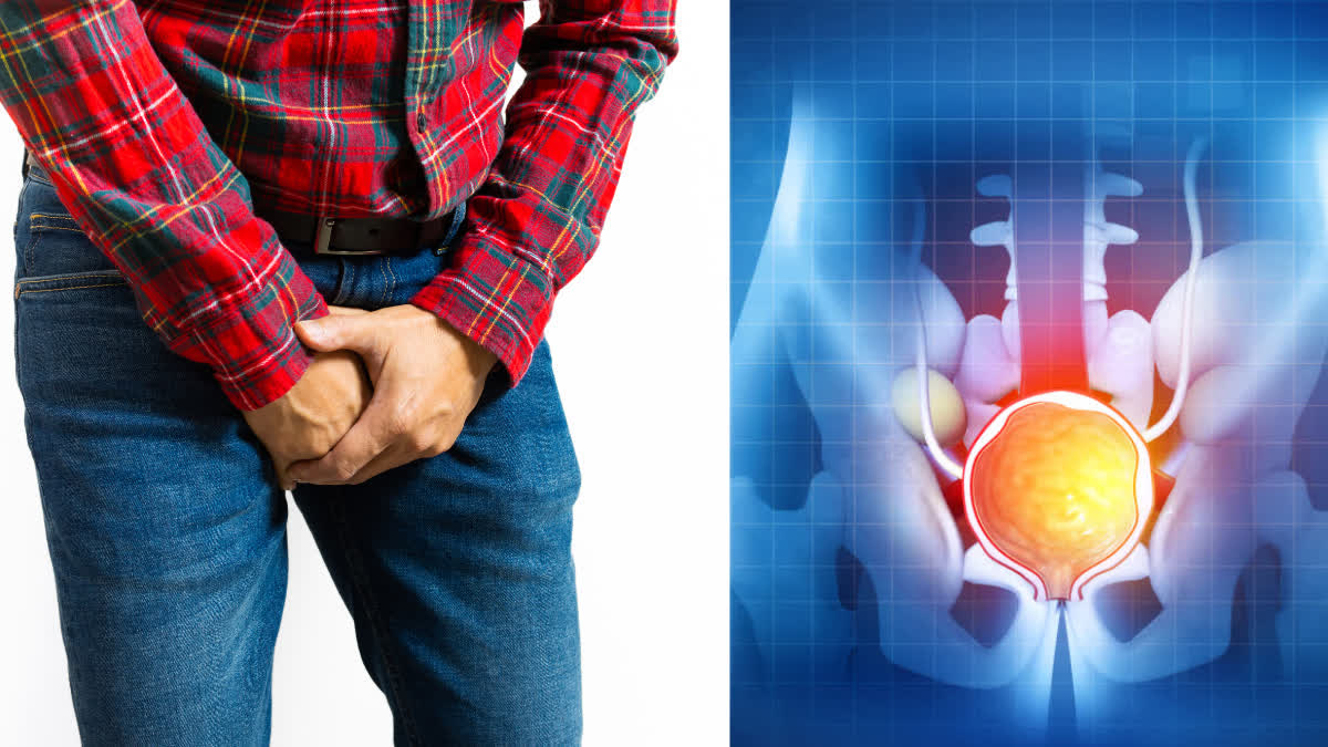 PROSTATE CANCER DETECTION