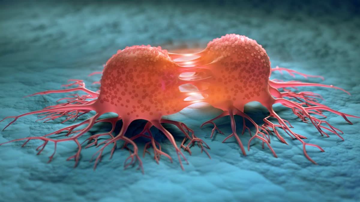 Why is cancer often detected only at the last stage? doctor explains the real reason