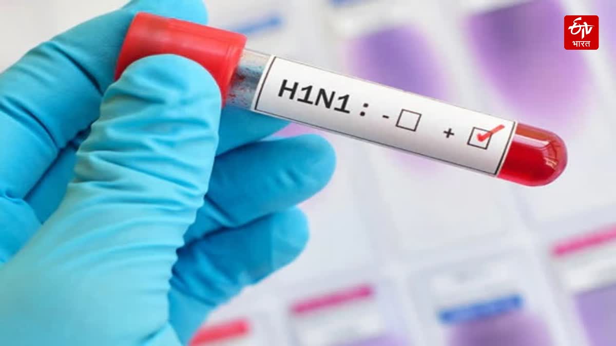 Swine flu virus