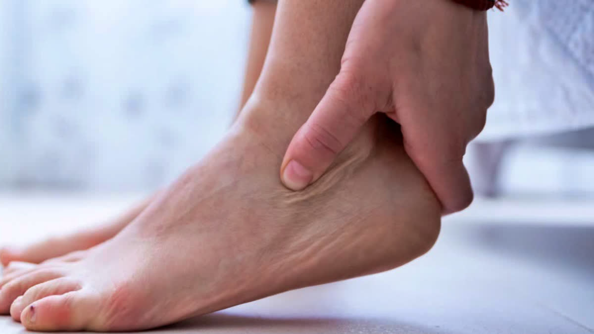 DOES SWOLLEN ANKLE MEAN HEART ISSUE