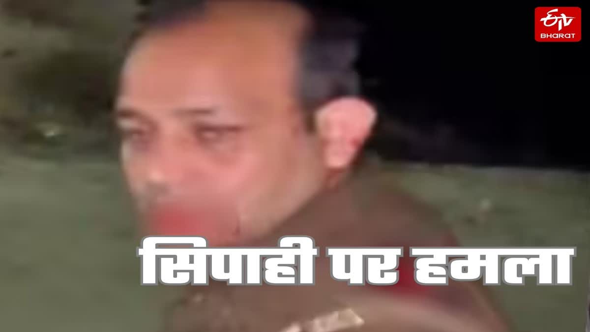 अमरोहा में सिपाही पर हमला.