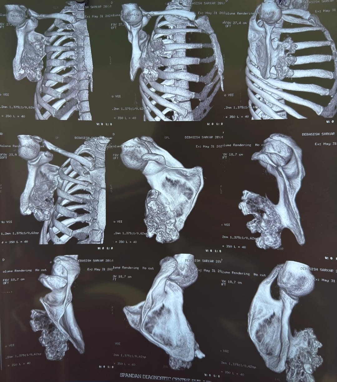 SILIGURI DISTRICT HOSPITAL