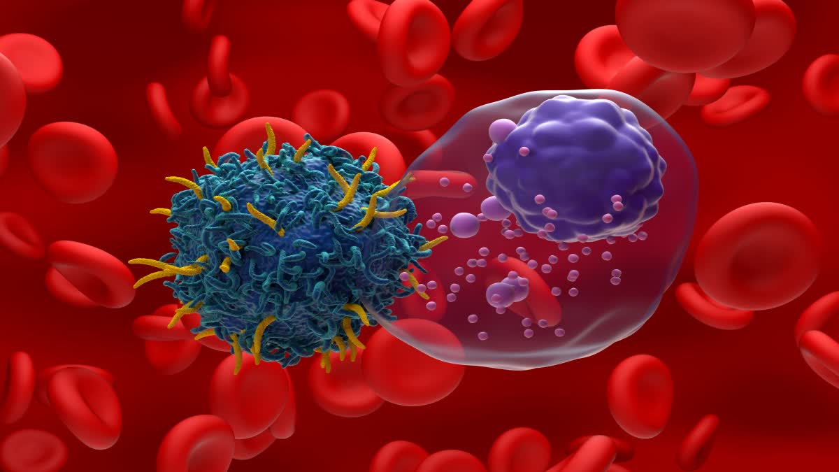 Multiple Myeloma