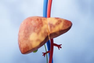 HIDDEN SIGN OF LIVER DAMAGE  SIGNS OF LIVER DAMAGE  WARNING SIGNS OF LIVER DAMAGE  SYMPTOMS OF HEPATIC DISEASE