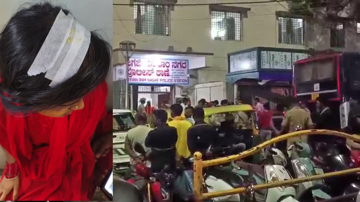 ಓಂ ಶಕ್ತಿ ಮಾಲಾಧಾರಿಗಳ ಮೇಲೆ ಅನ್ಯ ಕೋಮಿನ ಯುವಕರಿಂದ ಕಲ್ಲು ತೂರಾಟ, ಪ್ರಕರಣ ದಾಖಲು