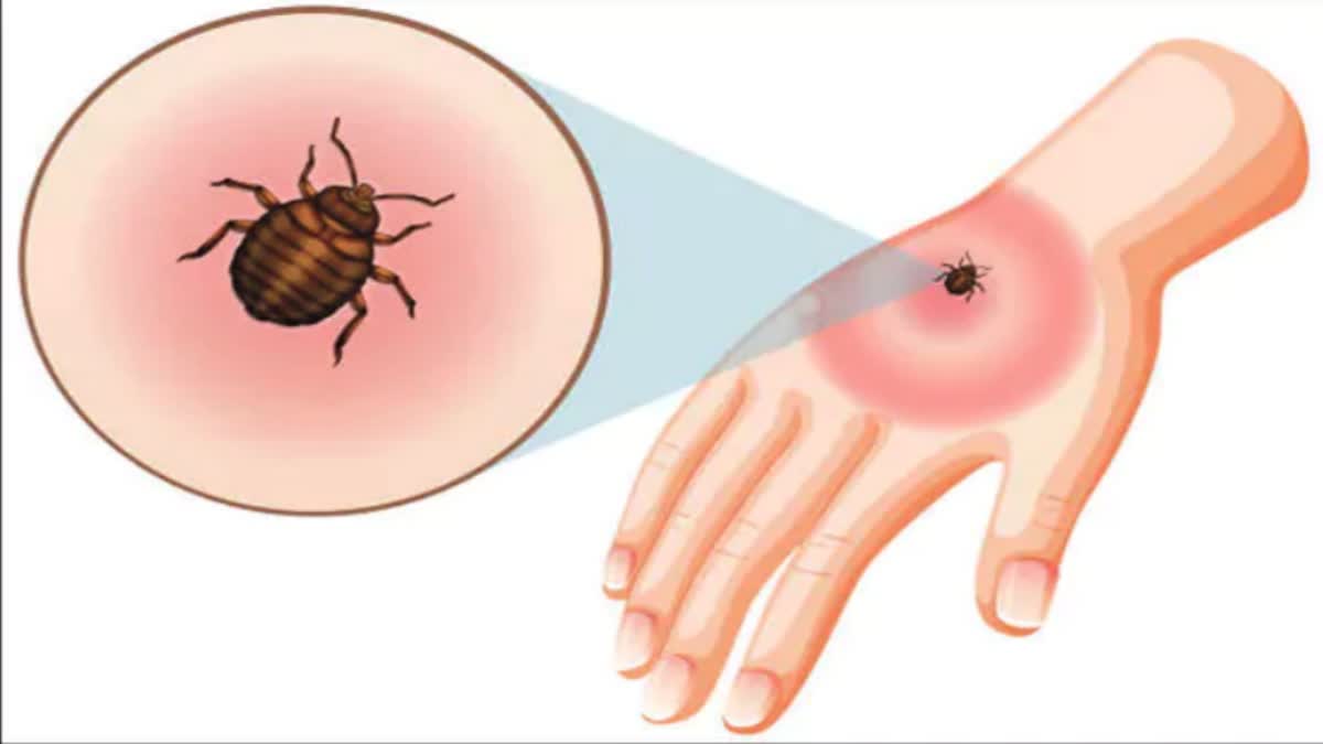 What Is Scrub Typhus Disease How To Prevent It
