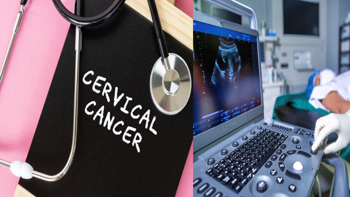 ಗರ್ಭಕಂಠದ ಕ್ಯಾನ್ಸರ್ನಿಂದ ಪ್ರತಿ ಎರಡು ನಿಮಿಷಕ್ಕೆ ಒಬ್ಬ ಮಹಿಳೆ ಸಾವು, ತಡೆಗಟ್ಟುವುದು ಹೇಗೆ?: ವಿಶ್ವಸಂಸ್ಥೆ ಸಲಹೆಗಳಿವು! Is cervical cancer dangerous Symptoms of cervical cancer How to prevent cervical cancer ಗರ್ಭಕಂಠದ ಕ್ಯಾನ್ಸರ್