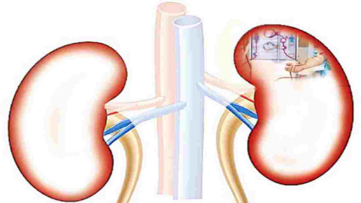 Researching For The Roots of Uddanam Kidney Disease