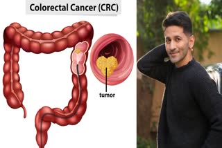 Vibhu Raghave's Tragic Death Highlights the Silent Killer: Warning Signs of Colon Cancer Men Often