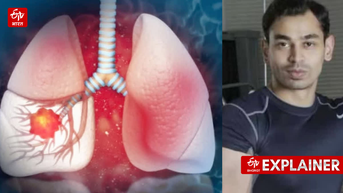 Prateek Yadav suffered from this serious lung condition Pulmonary Embolism. knowwhy this disease occurs