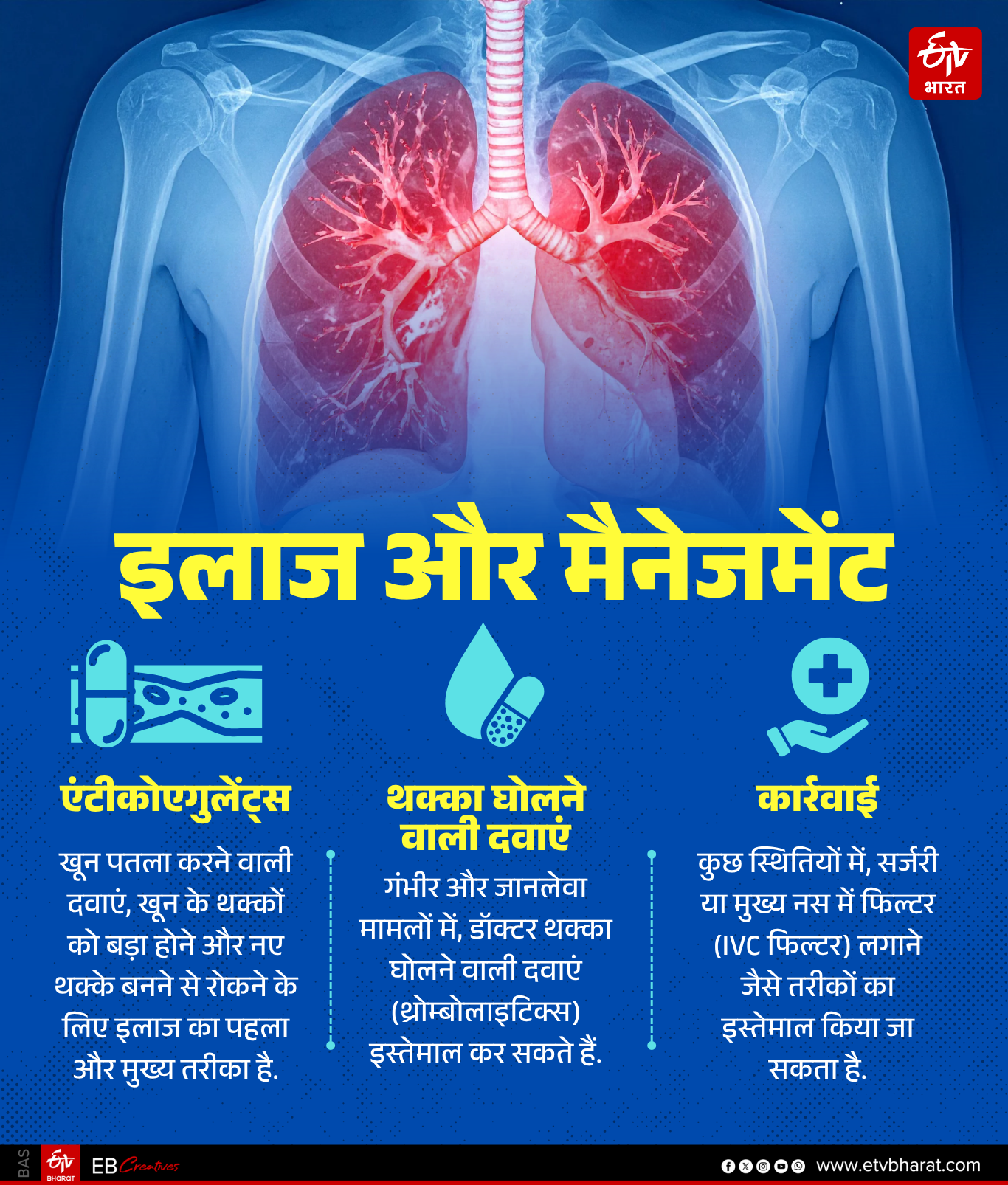 Prateek Yadav suffered from this serious lung condition Pulmonary Embolism. knowwhy this disease occurs