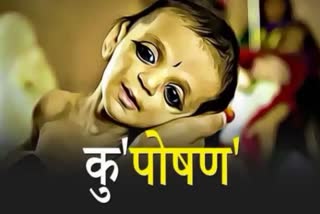 Madhya Pradesh malnutrition