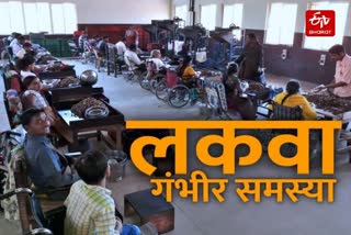 लकवा गंभीर बीमारी.