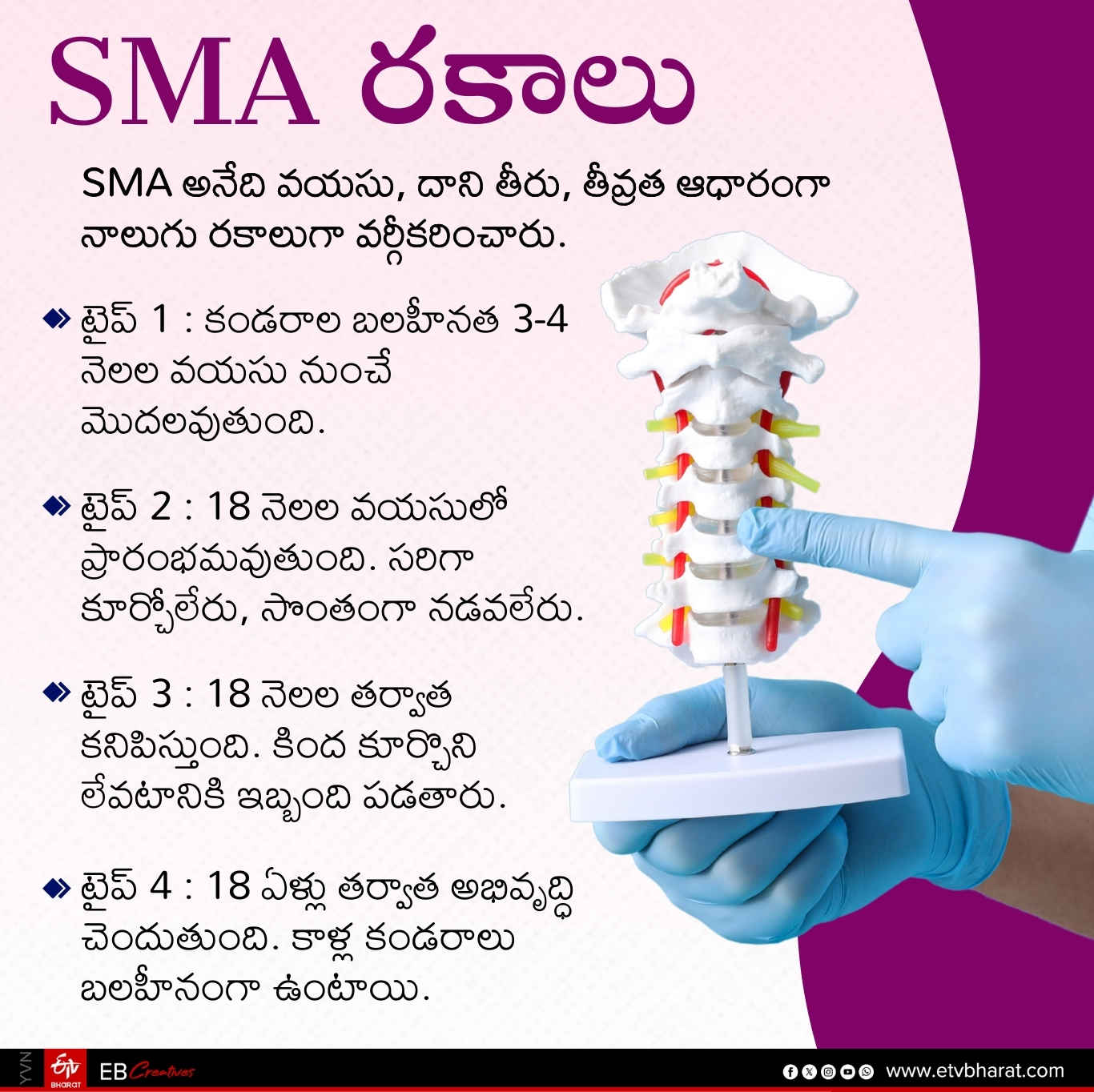 Types of SMA