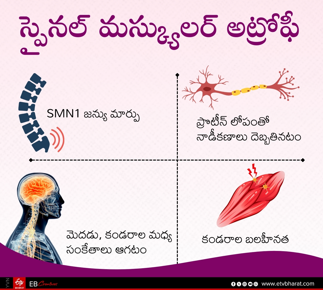 Spinal Muscular Atrophy