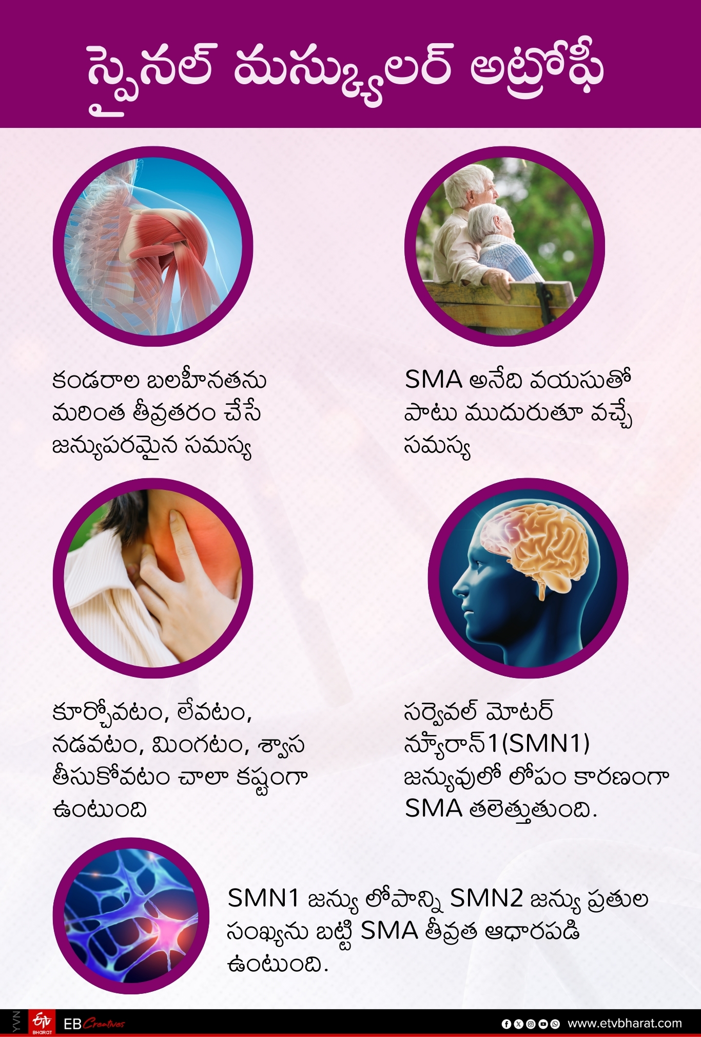 Spinal Muscular Atrophy