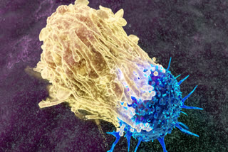 What is meningococcal meningitis and who gets it? Know its symptoms and causes.