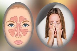 SINUS CANCER  SINUS CANCER SYMPTOMS  FIRST SIGNS OF SINUS CANCER  ಸೈನಸ್ ಕ್ಯಾನ್ಸರ್‌ನ ಕಾರಣ ಲಕ್ಷಣಗಳು