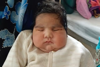 In a rare occurrence, a woman gave birth to a baby boy weighing 5.2 kg at Government Rani Durgavati Hospital in Jabalpur