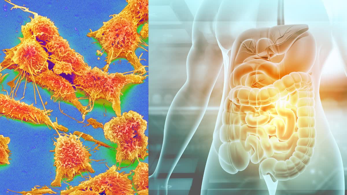 National Cancer Awareness Day 2025 Cancer Cases in Haryana Punjab Oncologist Dr Rakesh Kapoor PGIMER Chandigarh