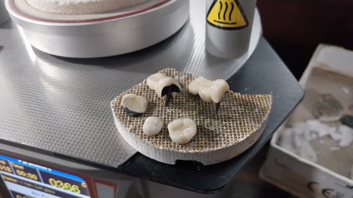 DENTAL LAB CLEANER SUCCESS STORY