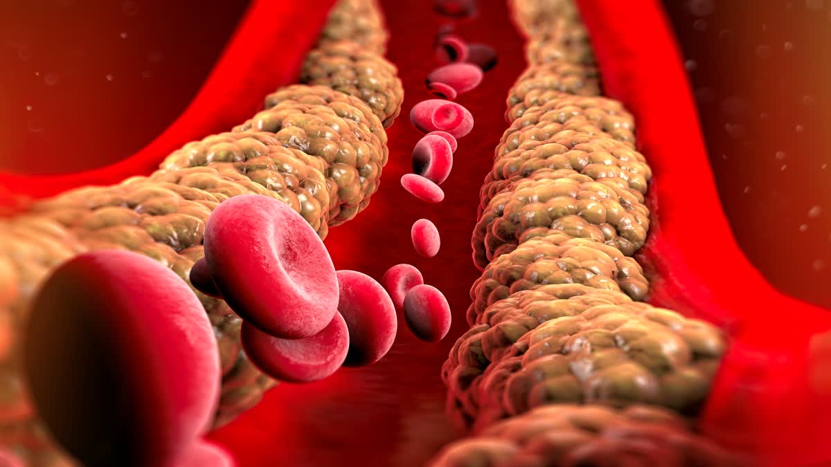 HOW TO LOWER CHOLESTEROL WITH DIET NATURAL WAYS TO LOWER CHOLESTEROL dangers of high cholesterol ಹೈ ಕೊಲೆಸ್ಟ್ರಾಲ್ ಕಡಿಮೆ ಮಾಡುವುದು ಹೇಗೆ