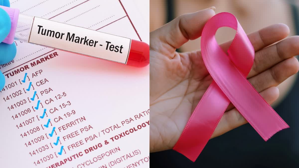 TUMOR MARKER TEST