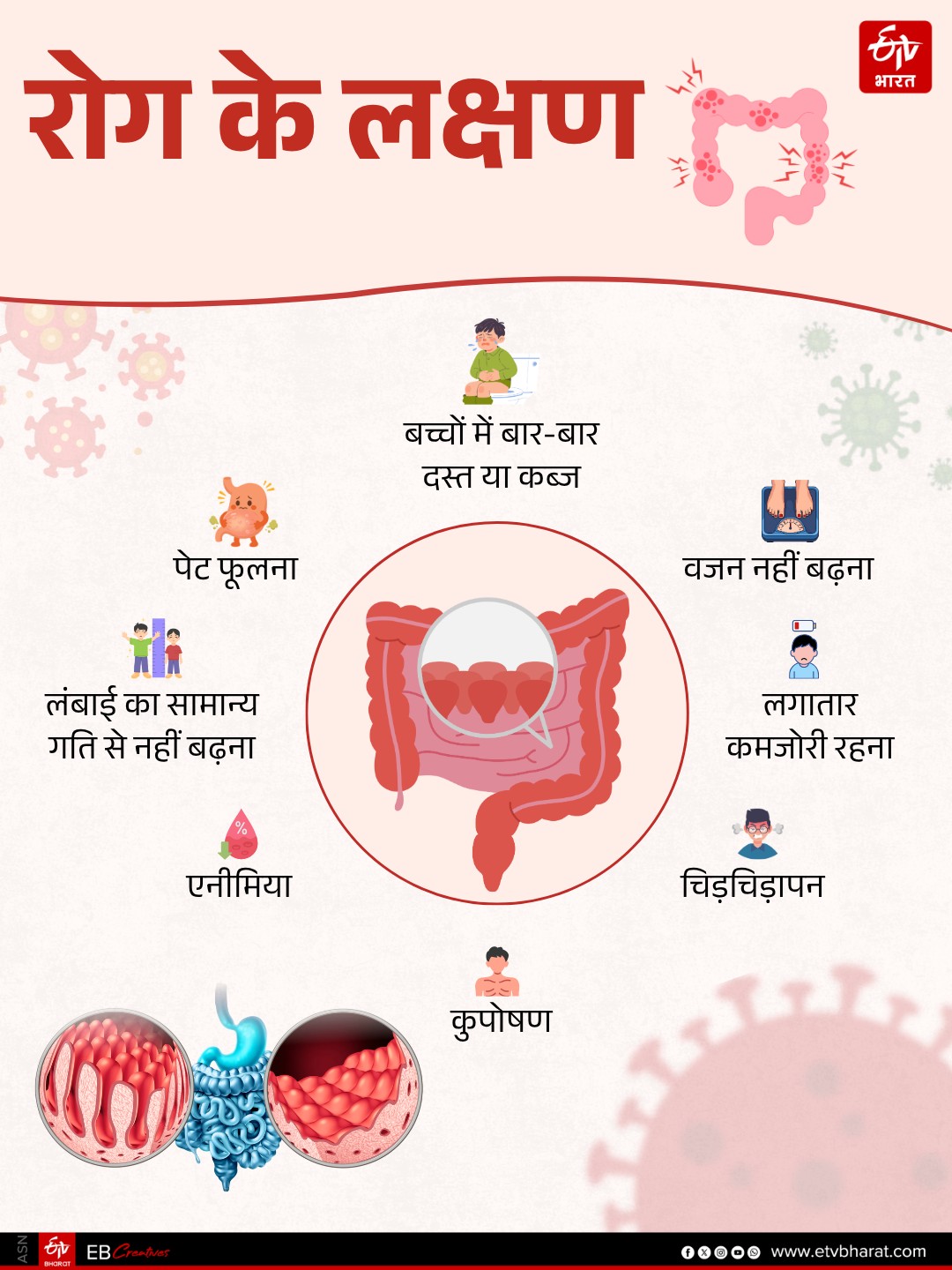 रोग के लक्षण