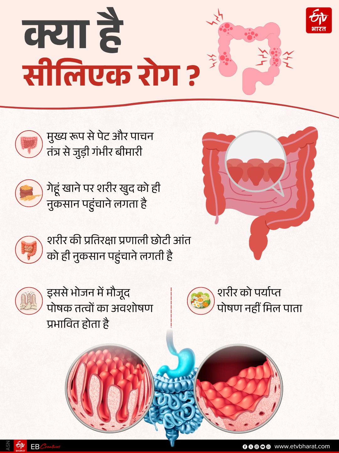 क्या है सीलिएक रोग